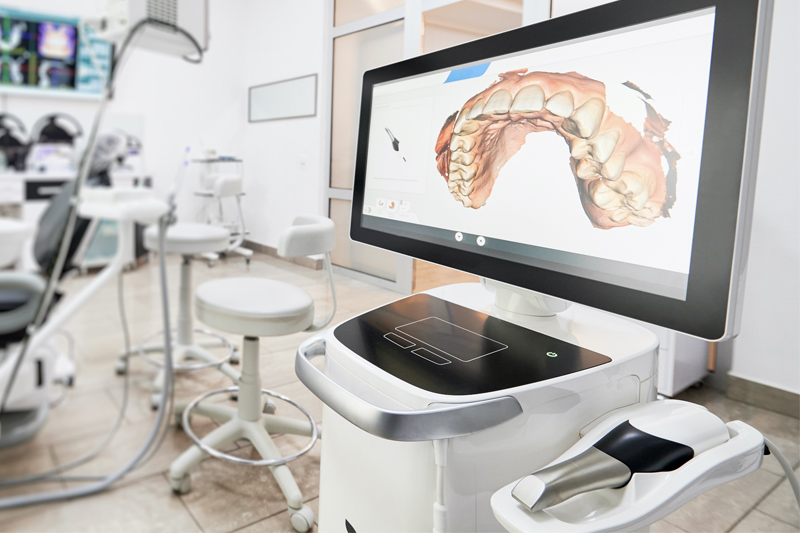 Intra-Oral Scanner in Laurel